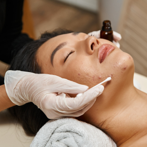 Dịch vụ trị mụn